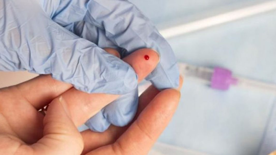 Atomo’s rapid COVID-19 test approved by TGA for distribution