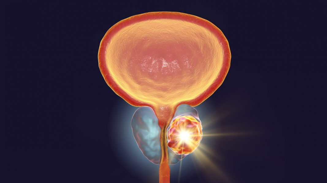 Telix submits FDA application for new prostate cancer imaging product