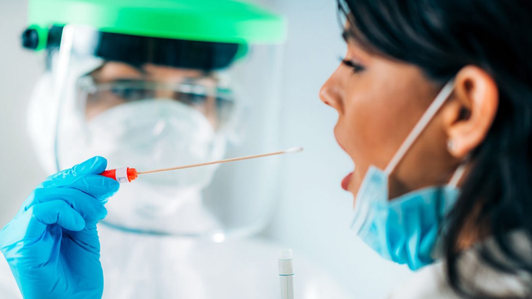 AnteoTech locks in rapid COVID-19 mucus test and planned commercialisation