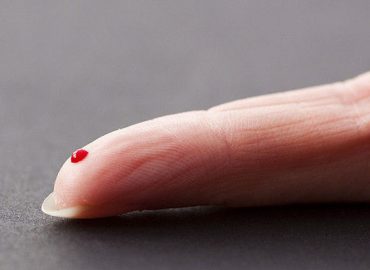 Universal Biosensors enters collaboration to diagnose cancer from a finger prick
