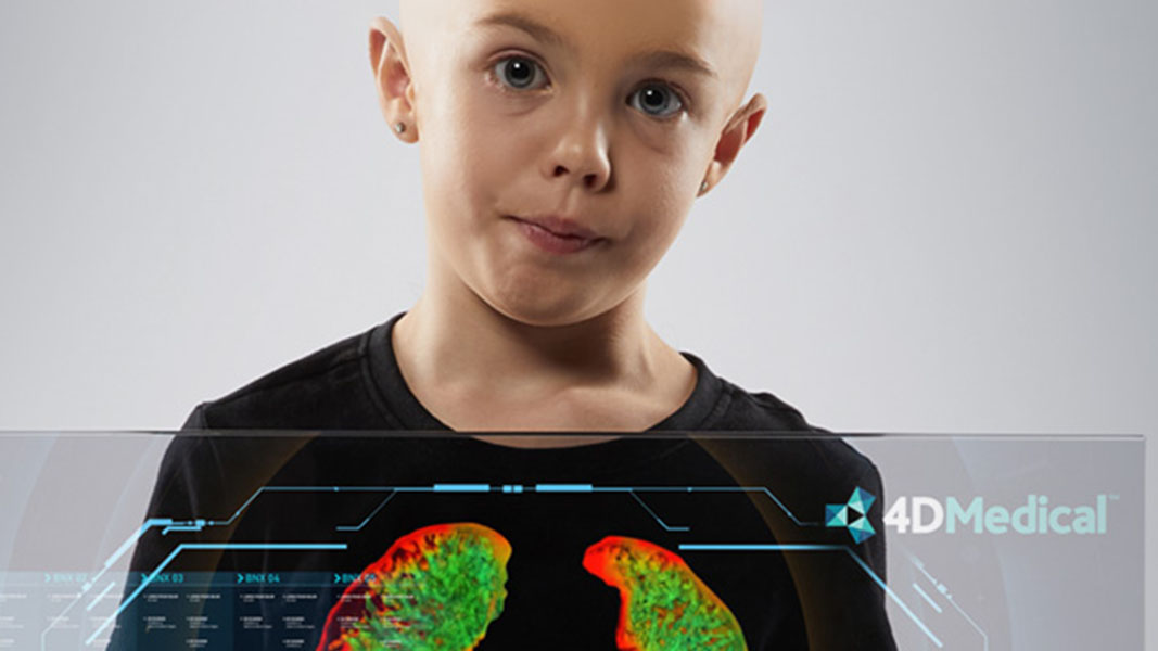 How 4DMedical is changing the medtech game post COVID