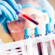 Fund Manager Meeting Notes – Rhythm Biosciences (ASX: RHY)