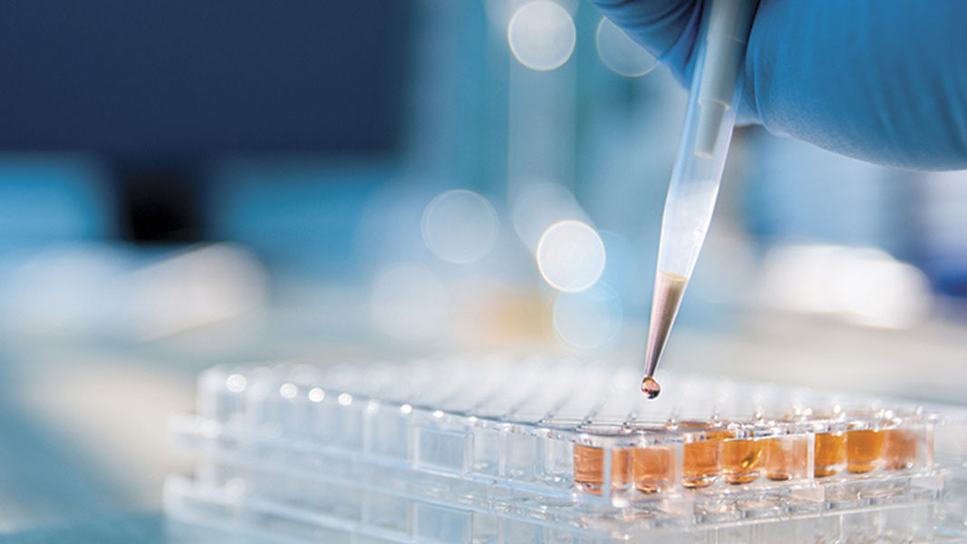 Proteomics International to collaborate on world first blood test for endometriosis