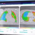 4DMedical’s clinical pilot program to progress following successful first phase