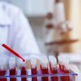 How BCAL Diagnostics is improving minimally invasive methods of early cancer detection
