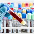 Predictive tests: diagnosing disease before it arises