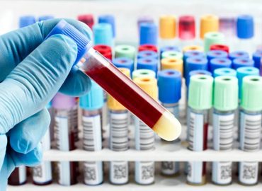 Predictive tests: diagnosing disease before it arises