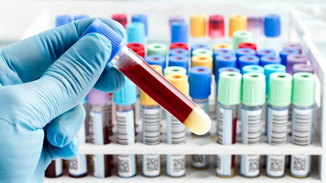 Predictive tests: diagnosing disease before it arises