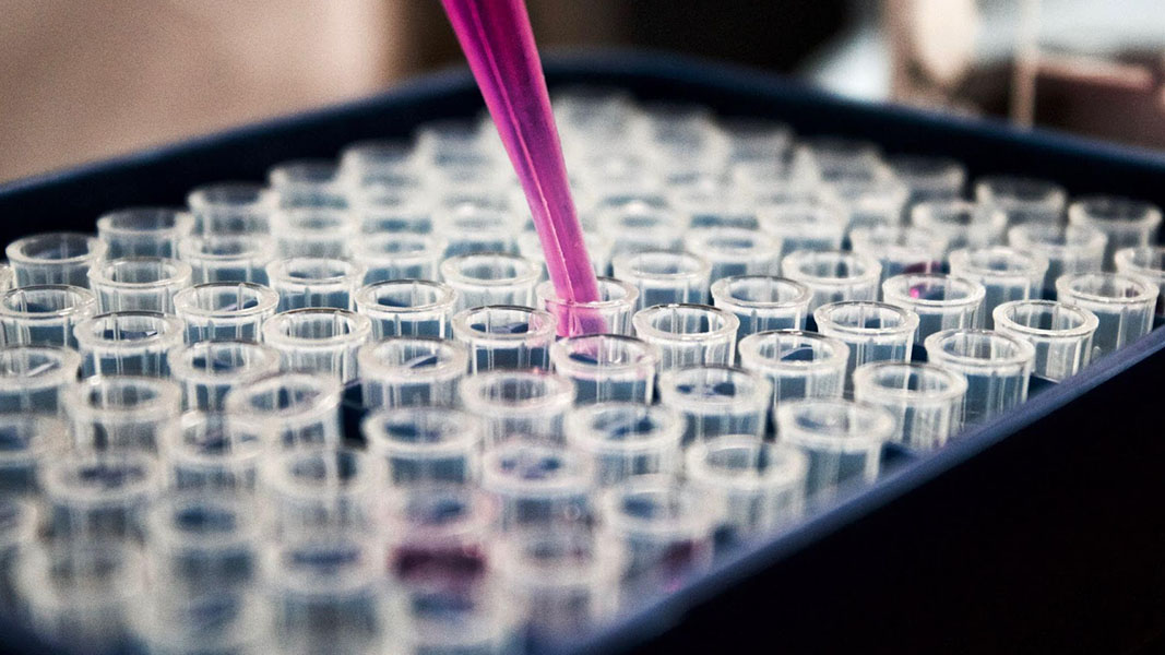 Out-the-box thinkers are just what the myelofibrosis treatment market needs
