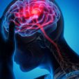 Nyrada drug offers potential world first oral treatment for concussion
