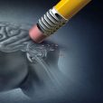 New trial results from Actinogen hold promise for Alzheimer’s treatment