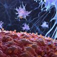 Rhythm Biosciences’ new clinical trial shows increases accuracy for their simple cancer blood test