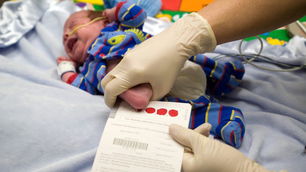 Lumos Diagnostics partners with Apatek to create rare disorder test for newborns