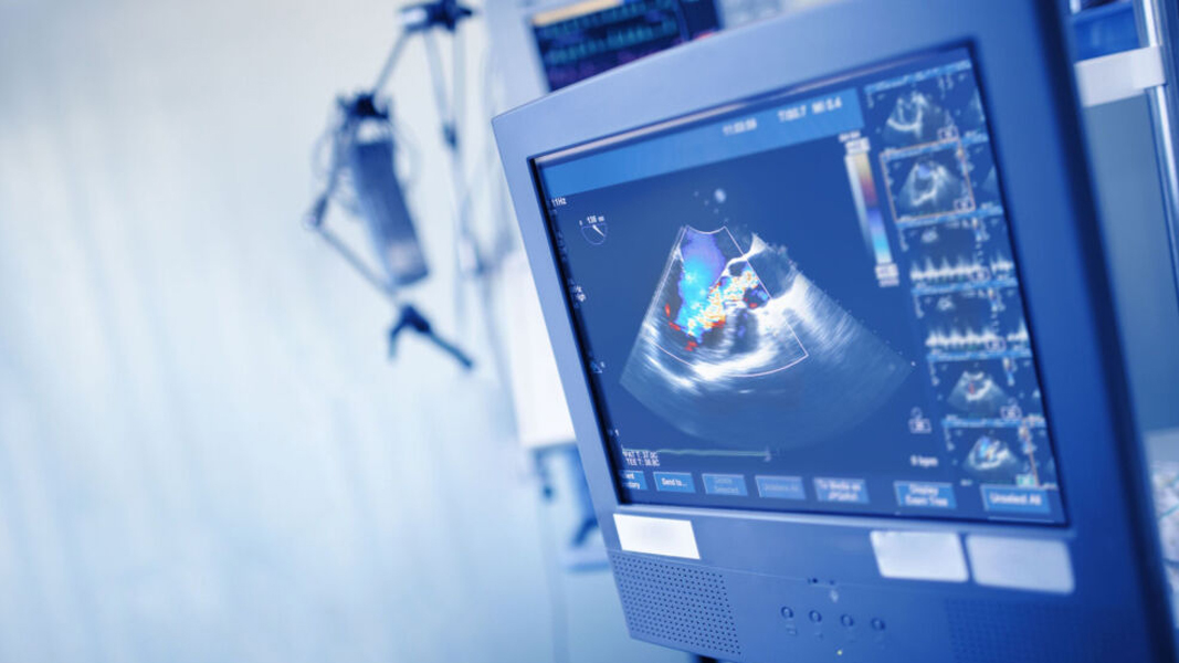 Gold Coast Private Hospital becomes first buyer for Echo IQ’s SaaS-enabled heart disease detector EchoSolv