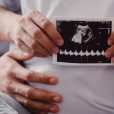 India records 10 new live births using Memphasys’ sperm selection device Felix