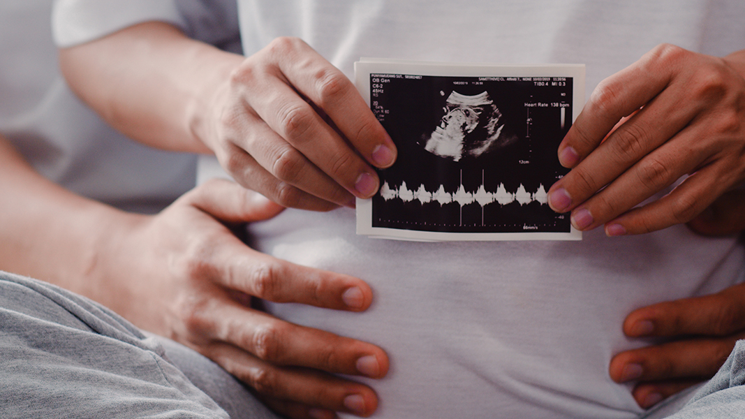 India records 10 new live births using Memphasys’ sperm selection device Felix