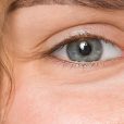 Nova Eye Medical reports surge in USA sales despite Medicare reimbursement uncertainty