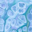 Cynata recruits first patient for Phase 2 trial of stem cells for graft vs host disease